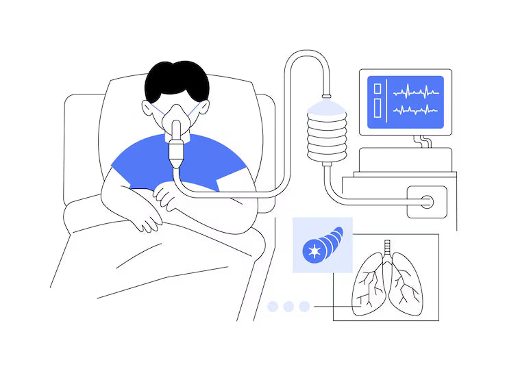 Ventiladores Pulmonares